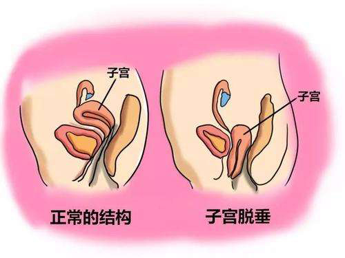 不孕不育到底应该怎样检查？哪些检查才对不孕的诊断有意义？