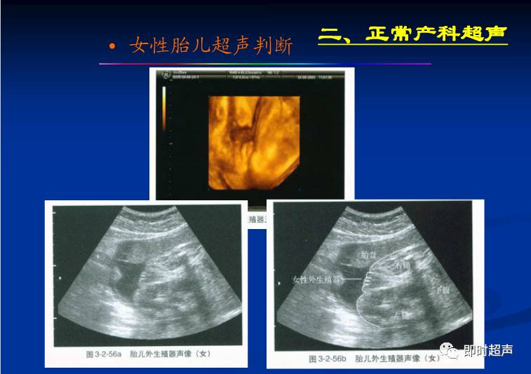 产前超声检查：胎儿正常超声表现及各项正常值解读